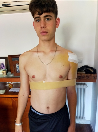 Ferran tras la cirugía de hombro